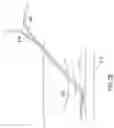 Fig. 09 - Medical assemblies and methods for implantation of multiple medical leads through a single entry