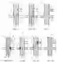Fig. 02 - Electromagnetic system for rapid cannulation of fenestrated endovascular grafts