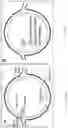Fig. 09 - Electromagnetic system for rapid cannulation of fenestrated endovascular grafts