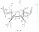 Fig. 02 - Valve prosthesis and method for delivery