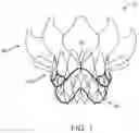 Fig. 08 - Valve prosthesis and method for delivery