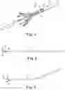 Fig. 02 - Delivery systems and methods of implantation for prosthetic heart valves