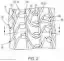 Fig. 03 - Expansion members for implantable devices and associated systems and methods