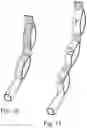 Fig. 18 - Strap for sling and method for manufacturing such a strap and use of such strap