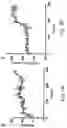 Fig. 13 - Extracorporeal life support system and methods of use thereof