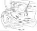 Fig. 17 - Extracorporeal life support system and methods of use thereof