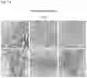 Fig. 02 - METHOD FOR TREATING GLIOBLASTOMA