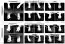 Fig. 01 - PHARMACEUTICAL COMPOSITION COMPRISING ISOLATED MITOCHONDRIA FOR PREVENTION OR TREATMENT OF RHEUMATOID ARTHRITIS