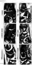 Fig. 06 - PHARMACEUTICAL COMPOSITION COMPRISING ISOLATED MITOCHONDRIA FOR PREVENTION OR TREATMENT OF RHEUMATOID ARTHRITIS