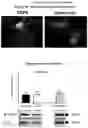 Fig. 02 - Compositions comprising bacterial strains