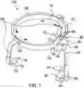 Fig. 02 - Ear and Nose Secretion Extractor Apparatus