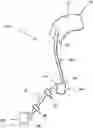 Fig. 01 - Therapeutic applications of artificial cerebrospinal fluid and tools provided therefor