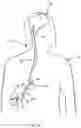 Fig. 04 - Therapeutic applications of artificial cerebrospinal fluid and tools provided therefor
