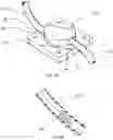Fig. 07 - Therapeutic applications of artificial cerebrospinal fluid and tools provided therefor