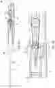 Fig. 05 - Steerable catheter handle design