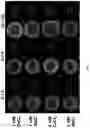 Fig. 09 - ENHANCED TREATMENT VOLUME AND SELECTIVE ABLATION USING ELECTROPORATION WITH ADJUVANT CALCIUM