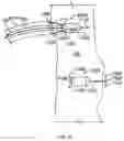 Fig. 09 - LEADLESS CARDIAC STIMULATION SYSTEMS