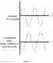 Fig. 06 - ACTIVE IMPLANTABLE MEDICAL DEVICE COMPRISING APPLICATION SPECIFIC INTEGRATED CIRCUIT AND METHOD THEREOF FOR HEATING CONTROL