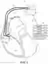 Fig. 02 - Ventricular sensing control in a cardiac pacing system