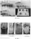 Fig. 06 - Water-based extraction and purification processes for cannabinoid acids