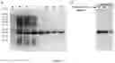 Fig. 07 - RAPID AND SIMPLE PURIFICATION OF ELASTIN-LIKE POLYPEPTIDES DIRECTLY FROM WHOLE CELLS AND CELL LYSATES BY ORGANIC SOLVENT EXTRACTION
