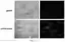 Fig. 09 - Recombinant herpes simplex virus having expression cassette expressing fused protein of cancer cell-targeting domain and extracellular domain of HVEM and use thereof