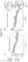Fig. 45 - Anti-human TREM2 antibodies and uses thereof