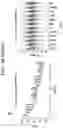 Fig. 49 - Anti-human TREM2 antibodies and uses thereof