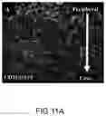 Fig. 18 - Cardiosphere-derived cell sheet and methods of making and using the same