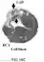 Fig. 29 - Cardiosphere-derived cell sheet and methods of making and using the same