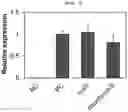 Fig. 06 - NOVEL SRNA PLATFORM FOR INHIBITING PROKARYOTIC EXPRESSION AND USE THEREOF