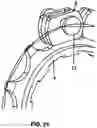 Fig. 13 - Power transmission chain