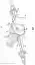 Fig. 02 - Axle assembly with variable speed pump