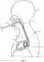 Fig. 02 - TRANS-ESOPHAGEAL TONOMETRY