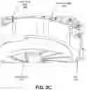 Fig. 07 - PILL FEEDER