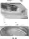 Fig. 08 - PILL FEEDER