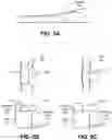 Fig. 11 - PILL FEEDER