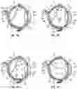Fig. 02 - METHODS AND DEVICES FOR TREATING A RETINAL DETACHMENT