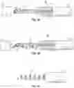 Fig. 06 - METHODS AND DEVICES FOR TREATING A RETINAL DETACHMENT
