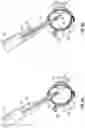 Fig. 07 - METHODS AND DEVICES FOR TREATING A RETINAL DETACHMENT