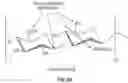 Fig. 09 - METHODS AND DEVICES FOR TREATING A RETINAL DETACHMENT
