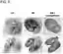Fig. 07 - METHOD AND COMPOSITION FOR REVERSING COGNITIVE IMPAIRMENTS AND LOSS USING SGLT2 INHIBITORS