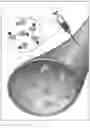 Fig. 02 - Albumin binding peptide-drug (AlBiPeD) conjugates and methods of making and using same