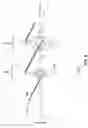 Fig. 06 - Adaptive deep brain stimulation using movement desynchronization