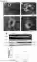 Fig. 09 - Modulation of neuronal NKCC1 as a therapeutic strategy for spasticity and related disorders