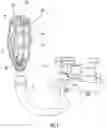 Fig. 02 - CONCRETE PUMP HOSE CLEANING DEVICE