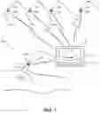 Fig. 02 - Ultrasound imaging system including wireless probe tracking