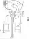 Fig. 02 - System for tracking and imaging a treatment probe