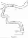 Fig. 15 - Electrically enhanced retrieval of material from vessel lumens