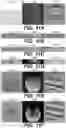 Fig. 17 - System, method and computer-accessible medium for facilitating noise removal in magnetic resonance imaging